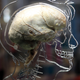 Photo: Matt Cardy/Getty Images